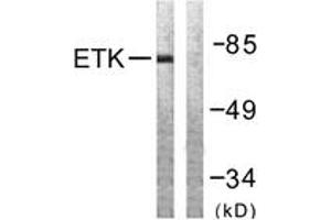 Western blot analysis of extracts from A549 cells, using ETK (Ab-566) Antibody. (BMX 抗体  (AA 532-581))