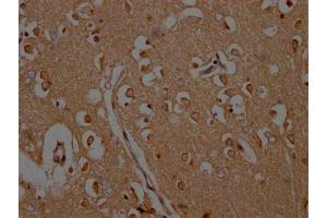 IHC image of ABIN7146439 diluted at 1:200 and staining in paraffin-embedded human brain tissue performed on a Leica BondTM system. (CAMK2A 抗体  (AA 321-478))