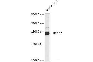 Western blot analysis of extracts of Mouse liver using RPRD2 Polyclonal Antibody at dilution of 1:3000. (RPRD2 抗体)