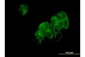 Immunofluorescence of monoclonal antibody to DNPEP on MCF-7 cell. (Aspartyl Aminopeptidase 抗体  (AA 1-475))