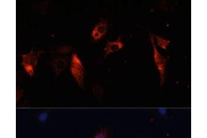 Immunofluorescence analysis of C6 cells using CTSL Polyclonal Antibody at dilution of 1:100. (Cathepsin L 抗体)