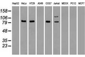 Western blot analysis of extracts (35 µg) from 9 different cell lines by using anti-anti-BRAFmonoclonal antibody. (BRAF 抗体)