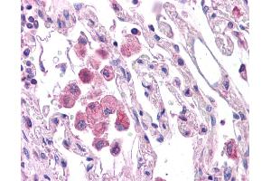 Immunohistochemistry (IHC) image for anti-HNF1 Homeobox A (HNF1A) (N-Term) antibody (ABIN2784536) (HNF1A 抗体  (N-Term))