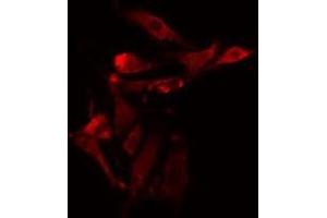 ABIN6275481 staining NIH-3T3 cells by IF/ICC. (RGS5 抗体  (Internal Region))