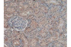 Detection of F2 in Rat Kidney Tissue using Polyclonal Antibody to Coagulation Factor II (F2) (Prothrombin 抗体  (AA 324-617))