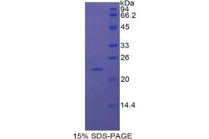 SDS-PAGE analysis of Mouse Interferon alpha 7 Protein. (IFNA7 蛋白)