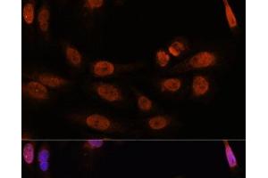 Immunofluorescence analysis of U-2 OS cells using THRB Polyclonal Antibody at dilution of 1:100. (THRB 抗体)