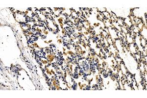 Detection of IRAK2 in Rat Lung Tissue using Polyclonal Antibody to Interleukin 1 Receptor Associated Kinase 2 (IRAK2)