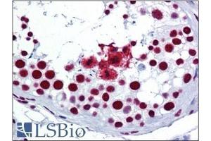 Human Testis: Formalin-Fixed, Paraffin-Embedded (FFPE) (SRSF3 抗体  (C-Term))