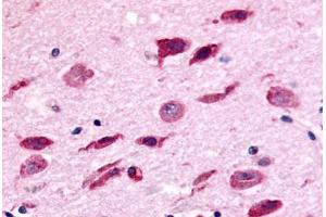 Immunohistochemistry (IHC) image for anti-NIMA (Never in Mitosis Gene A)- Related Kinase 9 (NEK9) (Kinase Domain) antibody (ABIN1049092)