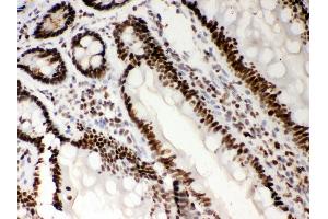 Anti- Nucleophosmin Picoband antibody,IHC(P) IHC(P): Rat Intestine Tissue