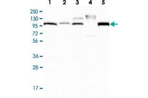 Western Blot analysis of Lane 1: RT-4 cell lysate, Lane 2: U-251 MG, Lane 3: Human plasma, Lane 4: Human Liver tissue, Lane 5: Human Tonsil tissue with APOB polyclonal antibody  at 1:250 - 1:500 dilution. (APOB 抗体)