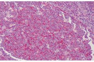 Human Tonsil: Formalin-Fixed, Paraffin-Embedded (FFPE) (TM7 抗体)