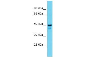 Western Blotting (WB) image for anti-Mitogen-Activated Protein Kinase Kinase 1 (MAP2K1) (N-Term) antibody (ABIN2788667) (MEK1 抗体  (N-Term))