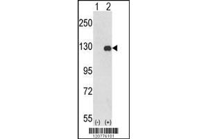 Western blot analysis of PTK2 using rabbit polyclonal PTK2 Antibody using 293 cell lysates (2 ug/lane) either nontransfected (Lane 1) or transiently transfected with the PTK2 gene (Lane 2). (FAK 抗体  (C-Term))