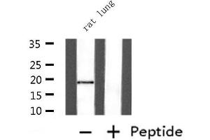 Western blot analysis of extracts from rat lung , using UBE2I  Antibody.