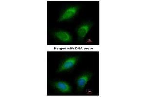ICC/IF Image Immunofluorescence analysis of paraformaldehyde-fixed HeLa, using RGL2, antibody at 1:200 dilution. (RGL2 抗体)