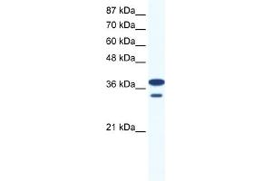 WB Suggested Anti-LHX3 Antibody Titration:  0. (LHX3 抗体  (Middle Region))