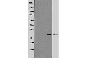 Western blot analysis of Interleukin 1β expression in HeLa cell lysate,The lane on the left is treated with the antigen-specific peptide. (IL-1 beta 抗体  (Internal Region))