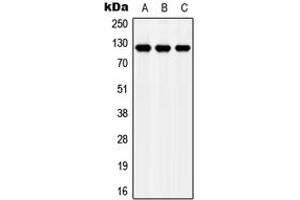 Western blot analysis of Apolipoprotein E Receptor 2 expression in MCF7 (A), NIH3T3 (B), H9C2 (C) whole cell lysates. (LRP8 抗体  (Center))