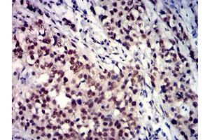 Immunohistochemistry (IHC) image for anti-TATA Box Binding Protein (TBP) (AA 1-144) antibody (ABIN7193395)