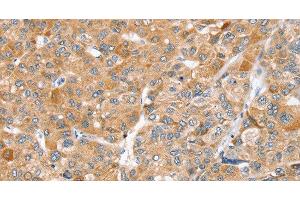 Immunohistochemistry (Paraffin-embedded Sections) (IHC (p)) image for anti-Zinc Finger Protein 36, C3H Type-Like 2 (ZFP36L2) antibody (ABIN7239518)