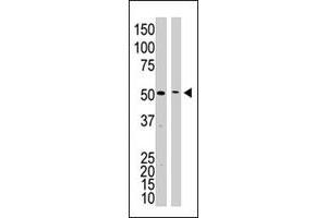 The PSEN1 polyclonal antibody  is used in Western blot to detect PSEN1 in mouse kidney tissue lysate (lane 1) and HL-60 cell lysate (lane 2) lysate. (Presenilin 1 抗体  (C-Term))