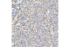 Immunohistochemistry of paraffin-embedded rat stomach using Phospho--S473 Rabbit mAb (ABIN6135179, ABIN6135970, ABIN6135971 and ABIN7101880) at dilution of 1:100 (40x lens). (AKT1 抗体  (pSer473))