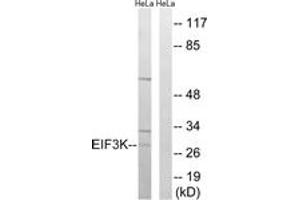 Western blot analysis of extracts from HeLa cells, using EIF3K Antibody. (EIF3K 抗体  (AA 61-110))
