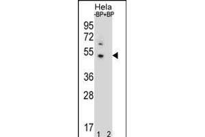 Western blot analysis of DNAJB6 Antibody (Center) Pab (ABIN656424 and ABIN2845716) pre-incubated without(lane 1) and with(lane 2) blocking peptide in Hela cell line lysate. (DNAJB6 抗体  (AA 218-247))
