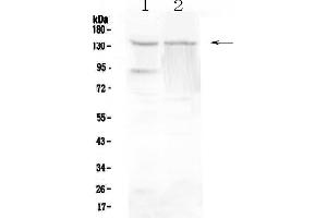 Western blot analysis of RTEL1 using anti-RTEL1 antibody .