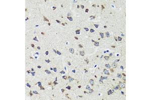 Immunohistochemistry of paraffin-embedded mouse brain using CCDC124 antibody  at dilution of 1:100 (40x lens). (CCDC124 抗体  (AA 1-223))
