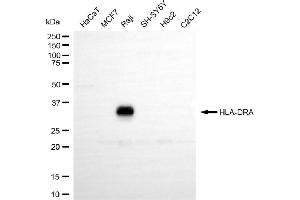 Western blotting analysis using HLA-DRA antibody (ABIN7798986).