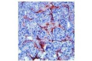 MMP9 antibody was used for immunohistochemistry at a concentration of 4-8 ug/ml.