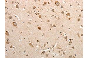 Immunohistochemistry (IHC) image for anti-Solute Carrier Family 12 (Sodium/potassium/chloride Transporters), Member 1 (SLC12A1) antibody (ABIN7131078)