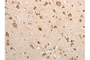 The image on the left is immunohistochemistry of paraffin-embedded Human brain tissue using ABIN7131078(SLC12A1 Antibody) at dilution 1/15, on the right is treated with fusion protein. (SLC12A1 抗体)