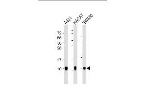 All lanes : Anti-S100A2 Antibody at 1:4000 dilution Lane 1: A431 whole cell lysate Lane 2: HACAT whole cell lysate Lane 3: S whole cell lysate Lysates/proteins at 20 μg per lane. (S100A2 抗体)