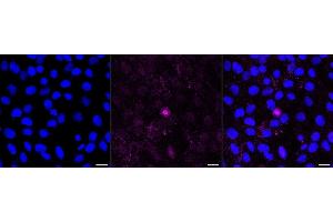 Immunocytochemical staining of H9c2 cells with Haptoglobin antibody (ABIN7798837), 1:1,000). (Recombinant Haptoglobin 抗体)