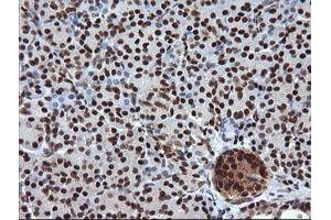 Image no. 3 for anti-Tripartite Motif Containing 38 (TRIM38) (AA 1-265) antibody (ABIN1490681)