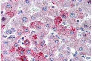 Human Liver (formalin-fixed, paraffin-embedded) stained with CCR10 antibody ABIN291274 at 5 ug/ml followed by biotinylated goat anti-rabbit IgG secondary antibody ABIN481713, alkaline phosphatase-streptavidin and chromogen. (CCR10 抗体  (AA 350-362))