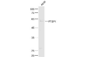 A549 lysates probed with PTBP1 Polyclonal Antibody, Unconjugated  at 1:500 dilution and 4˚C overnight incubation. (PTBP1 抗体  (AA 451-531))