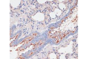 Immunohistochemistry of paraffin-embedded Rat lung using ZNRF3 Polyclonal Antibody at dilution of 1:100 (40x lens). (ZNRF3 抗体)