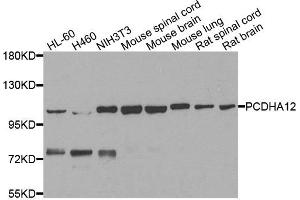 Western blot analysis of extracts of various cells, using PCDHA12 antibody. (PCDHA12 抗体)