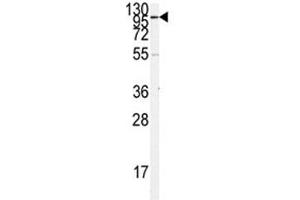 Western Blotting (WB) image for anti-Angiotensin I Converting Enzyme 2 (ACE2) (AA 59-90) antibody (ABIN3029962)