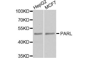 Western blot analysis of extract of HepG2 and MCF7 cells, using PARL antibody. (PARL 抗体)