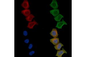 ABIN6259394 and ABIN6276164 staining Hela cells(45 min of heat-shock) by IF/ICC.