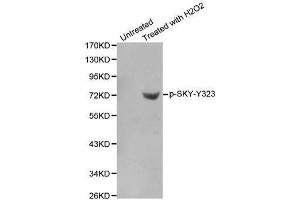 Western blot analysis of extracts from Jurkat cells using phospho-SYK-Y323 antibody. (SYK 抗体  (pTyr323))