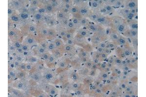 IHC-P analysis of Human Liver Tissue, with DAB staining. (ITFG1 抗体  (AA 55-306))