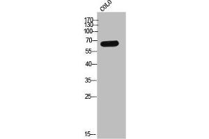 Western Blot analysis of COLO cells using Eme1 Polyclonal Antibody (Crossover junction endonuclease EME1 (EME1) (Internal Region) 抗体)