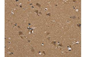The image on the left is immunohistochemistry of paraffin-embedded Human brain tissue using ABIN7192079(PUS10 Antibody) at dilution 1/45, on the right is treated with synthetic peptide. (PUS1 抗体)